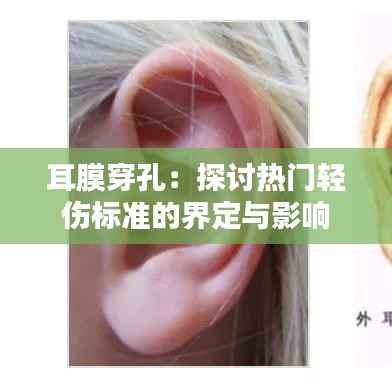 耳膜穿孔：探讨热门轻伤标准的界定与影响