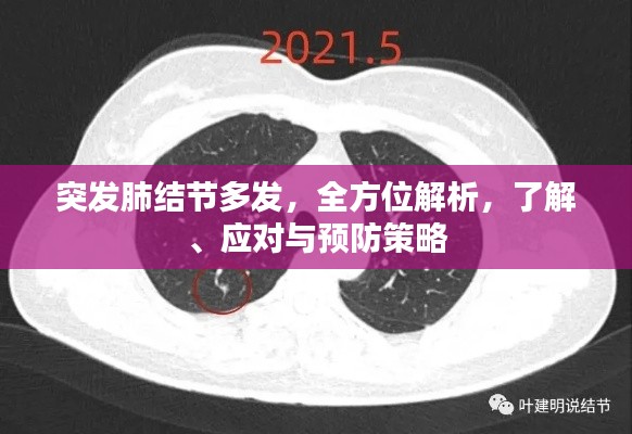突发肺结节多发，全方位解析，了解、应对与预防策略